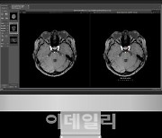 딥노이드, 업계 최초 뇌동맥류 AI 진단 솔루션 보험 등재