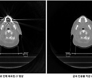 수리과학연, 금속인공물에 의한 CT 영상 왜곡 줄이는 기술 개발