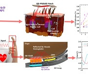 웨어러블 전자약으로 탈모 치료…QD-OLED 패치 세계 최초 개발