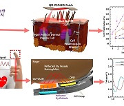 탈모 치료용 웨어러블 패치 개발…"모유두 세포 23%↑"