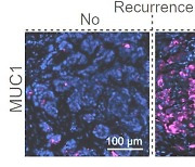 암 재발 돕는 유전자 발견했다…"1개는 임상시험 중"