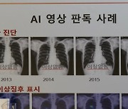 어디서든 엑스레이…해외도 '똑똑'