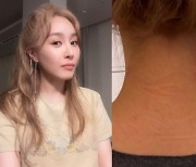 '흡연 연습' 옥주현, 이번엔 목 관통 장침 맞았다…"무서워"