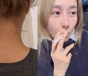 '흡연 논란' 옥주현, 이번엔 목에 장침 꽂아 "흔치 않은 일"