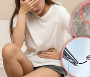 18년간 하복부 통증… 의료진 실수로 자궁 속 부러진 바늘 '충격'