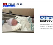 [단독] 원정출산 업체, 산모 사망에도 '안전하다' 계속 영업