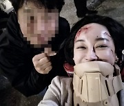 김혜은 "교통사고 사진 올려도 되지요?"…해맑은 미소