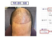 성형시술을 ‘무좀치료’ 등으로 둔갑…줄줄 샌 보험료가 무려