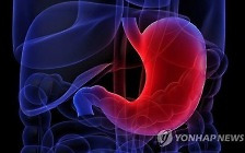 [김길원의 헬스노트] "위암 60%가 동아시아에 몰린 이유…가족력 영향 커"