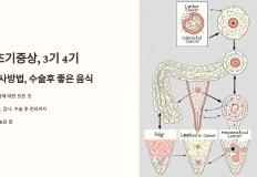 대장암 초기증상, 3기 4기 생존율, 검사방법, 수술후 좋은 음식 이미지