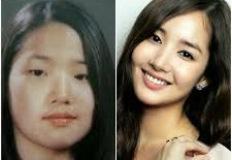 어릴 때와 지금 얼굴이 다르다고? 성형 사실 당당히 밝힌 여배우 이미지