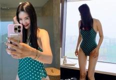 장영란, '다이어트 퀸'으로 난리! 외모도 사업도 포텐 터진 40대 동안미모 바캉스룩 이미지
