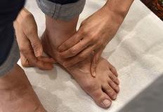 다리 이 증상 "혈관 썩어가고 있는겁니다" 병원가세요 이미지