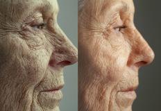 딥러닝 모델 'FaceAge', 얼굴 나이로 건강 예측하는 인공지능 이미지