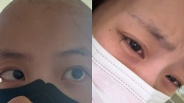 '걸그룹 굿데이' 류지원, 백혈병 투병 고백..
