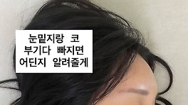 랄랄, 코수술 대성공? 확 바뀐 '날렵' 콧날 [스한★그램]