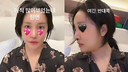랄랄, 성형 후 다른 사람 됐다.. 정석미녀 그 자체 [RE:스타]