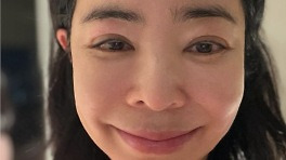 눈 퉁퉁 부은 이혜영, 폐암·담석증 이어 림프 부종도 겪었다…