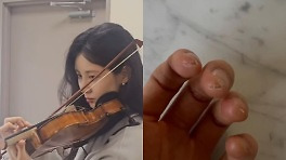 바이올린 잡은 서현, 손가락 상태 보니…