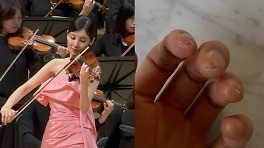 소녀시대 서현 '굳은살 투혼'…'특혜 논란' 이겨냈다