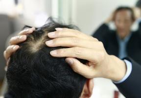이거 모르고 모자쓰면 탈모옵니다 이미지