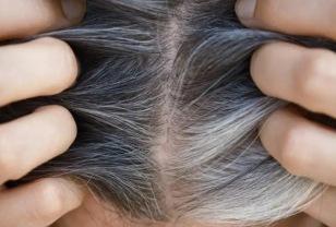 "검은콩만 찾지 말고" 흰머리 고민이라면 '이 음식' 드세요 이미지