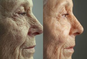딥러닝 모델 'FaceAge', 얼굴 나이로 건강 예측하는 인공지능 이미지