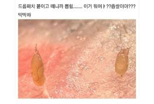 아니 턱에서 이거 나옴 ㅋㅋㅋㅋㅋ 이미지