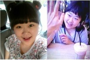 “부상인 줄 알았는데…” 병명 듣고 오열한 국민 개그우먼의 최후 이미지