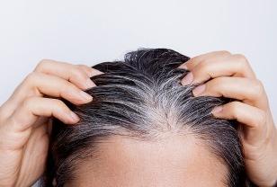 흰머리 "이 곳에 보인다면" 몸이 보내는 경고일 수 있어요. 꼭 알아두세요 이미지