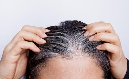 흰머리 "이 곳에 보인다면" 몸이 보내는 경고일 수 있어요. 꼭 알아두세요 이미지