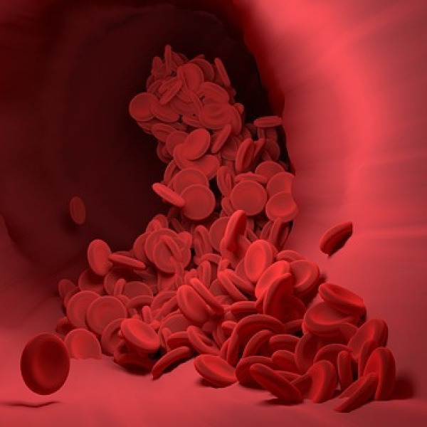 혈관 지방, 이걸로 진짜 싹 녹습니다! 의사들도 인정한 혈관 기름 없애는 식재료 TOP 3