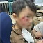 광견병 백신 접종 18일 뒤 사망한 中 3세 아이…면역 실패에 당국 조사[여기는 중국]