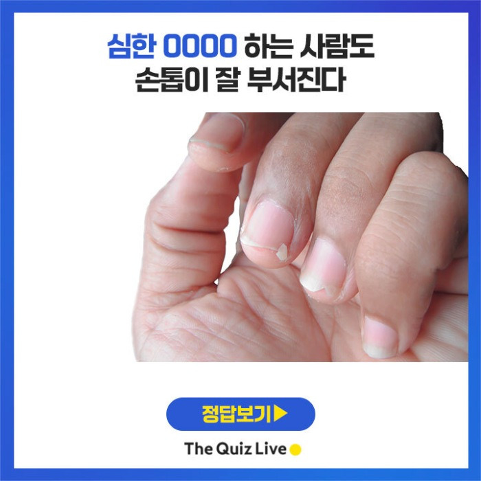 손톱에바나나 이미지