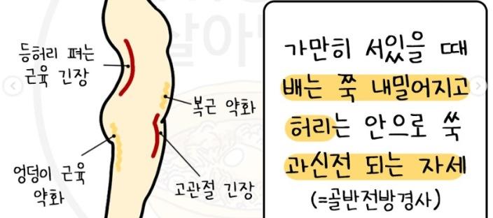 코어 무너진 사람 자세 특징 + 코어 레벨 테스트 이미지