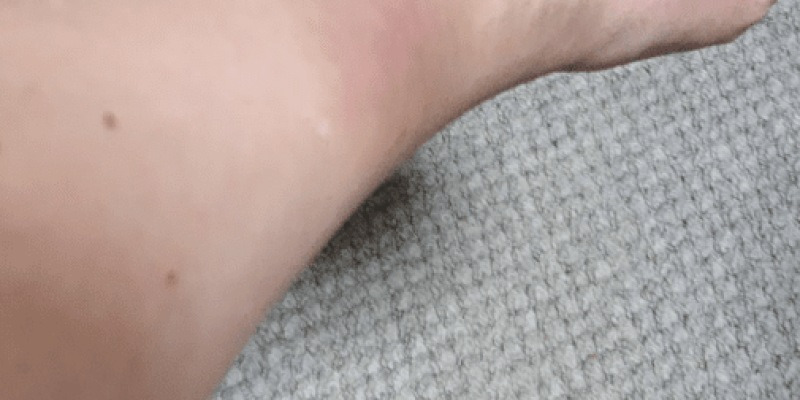 血液のがんになると真っ先に現れる「この症状」、今すぐチェックしてみてください。