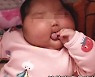 아기 크림 발랐더니 얼굴이 풍선처럼.. '호르몬 크림' 발칵