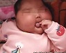 유아용 크림 바른 5개월 아기, 얼굴 부풀어 오르는 부작용 '심각'