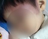 여친 4살 아들 피멍 들게 때린 40대 "합의 시간 달라"