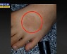 급식에 모기 기피제 뿌린 교사..CCTV에 추가 범행 들통