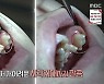 '생방송 오늘아침' 소개 구강관리 비결..구강세정기 '아쿠아픽' 관심
