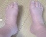 세쌍둥이 출산 코앞 황신영 "몸무게 103kg, 서 있기도 힘들어"