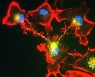 뇌의 독성 단백질 분해하는 면역세포 '분업 시스템' 발견