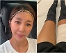 전미라, ♥윤종신이 말릴만했네..축구하다 햄스트링 파열 '붕대 칭칭'