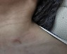 보육교사 위협·폭행에 6세 아동 뒷걸음질..CCTV 영상 학대 적발