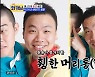 이상준, 모발이식 전 모습 공개.."저 사진 어떻게 구한거냐" 당황(와카남)