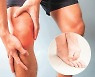 [의료계 소식]무릎 골관절염 환자, 손발톱 무좀 더 잘 걸린다