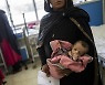 영양실조 200만, "약도 의사도 없다"..의료시스템 붕괴된 아프간