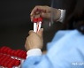충북 16명 코로나19 추가 확진..학교·직장 집단감염 지속