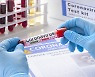 식약처 "코로나19 항체검사시약, 면역력 확인 불가"